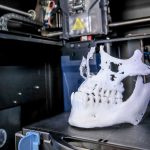 3D printing in orthognathic surgery | Medimodel