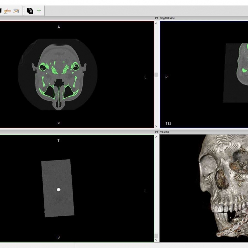 3D print a DICOM file | Medimodel