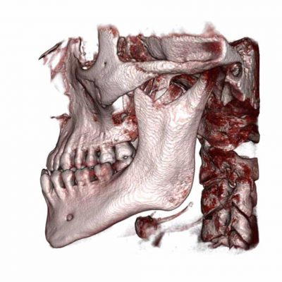 CT-Scan-skull | Medimodel