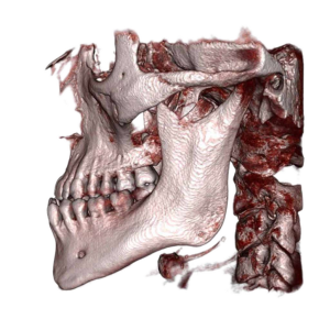 dicom1 | Medimodel