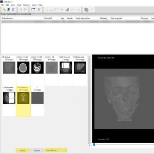 3D print a DICOM file | Medimodel