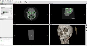 3D print a DICOM file | Medimodel