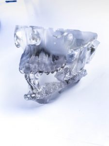 3D print a DICOM file | Medimodel