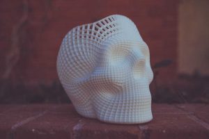 3D-Printing-For-Orthopaedic-Surgery | Medimodel