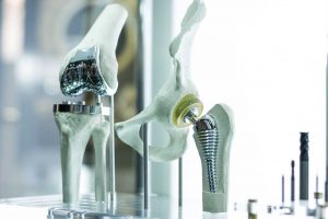 Orthopedic-3d-printing | Medimodel