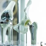 Orthopedic-3d-printing-image | Medimodel