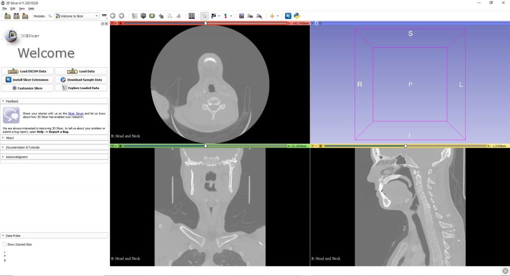 How to anonymise a DICOM file from CT and MRI scan images