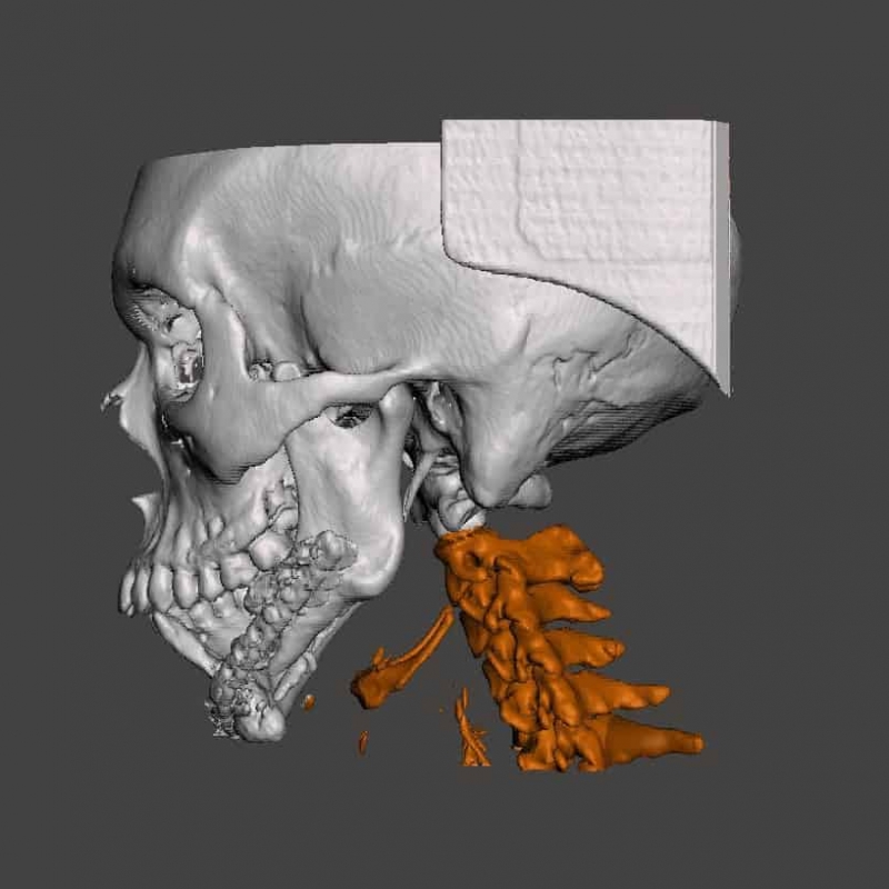 3D print a DICOM file
